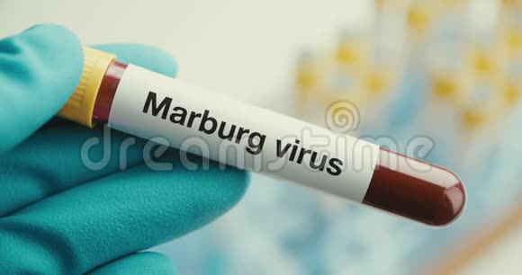 近距离科学家手套实验室试管保护马尔堡病毒阳性背景视频的预览图