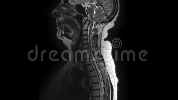 术后女性器官MRI检测转移视频的预览图