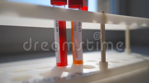 在实验室或医院的架子上添加新的带有血样的试管到冠状病毒中实验室检测血液视频的预览图