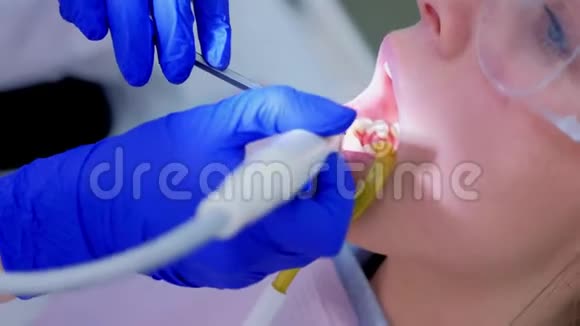 年轻女性牙科用口腔超声洁牙手术视频的预览图
