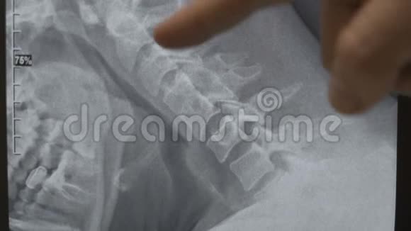 颈椎X光片视频的预览图