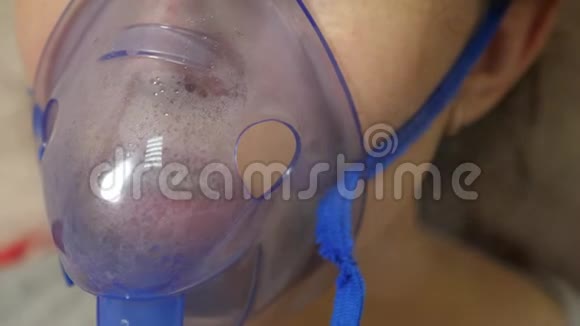 咳嗽治疗特写镜头一名戴口罩的患病妇女被吸入戴着蓝色医院面具的女孩吸入蒸气处理视频的预览图