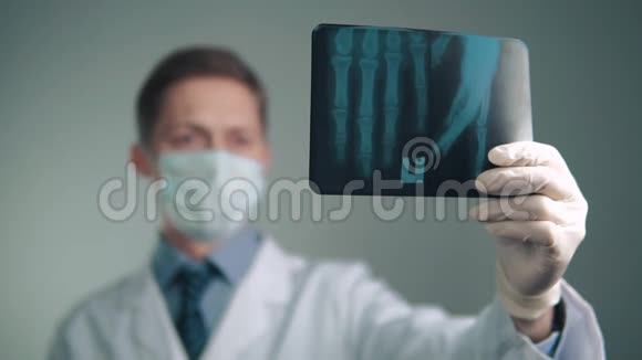 医生手中的X光视频的预览图