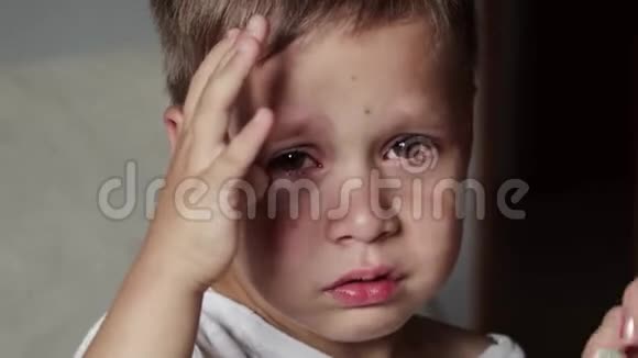 一个哭哭啼啼的可爱生病的男孩的肖像视频的预览图