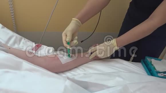 护士无菌手套将手注入静脉导管视频的预览图