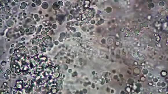 乳杆菌和棒状芽孢杆菌团在显微镜下迅速移动视频的预览图