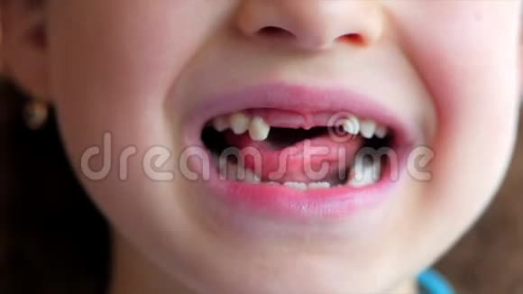 一个小女孩的特写微笑宝贝牙齿孩子咬他的舌奶牙视频的预览图