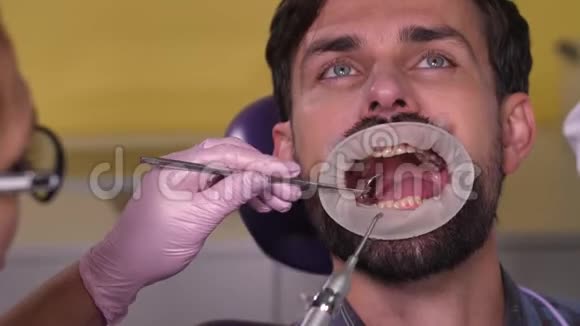 牙科清洁期间男性病人画像视频的预览图