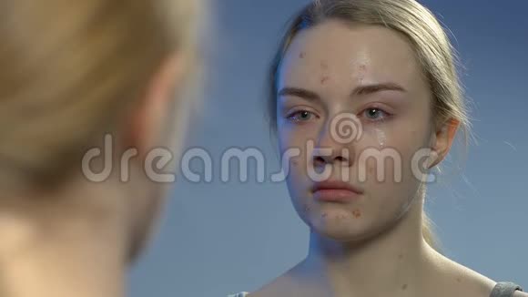 哭着的年轻女士厌恶地看着镜子里的痤疮尴尬的年龄视频的预览图