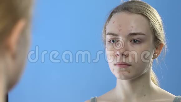 青春痘少女照镜子年轻时皮肤病问题视频的预览图