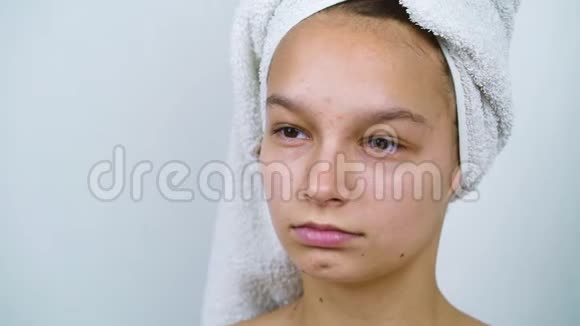 少女头上戴浴巾脸上长痘痘视频的预览图