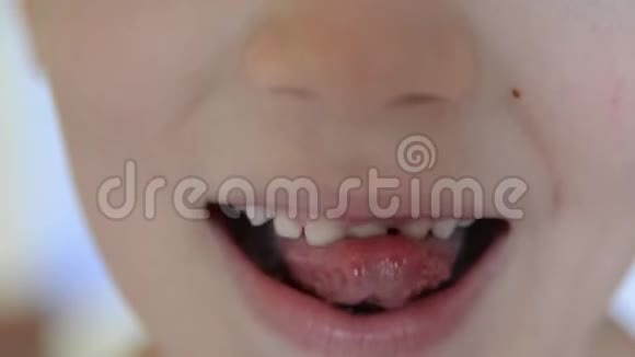 子牙就要掉出来了牛奶护理可爱的男孩碰奶牙视频的预览图