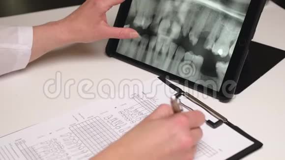 女牙医看着药片上的x光牙齿填写检查表格关门视频的预览图