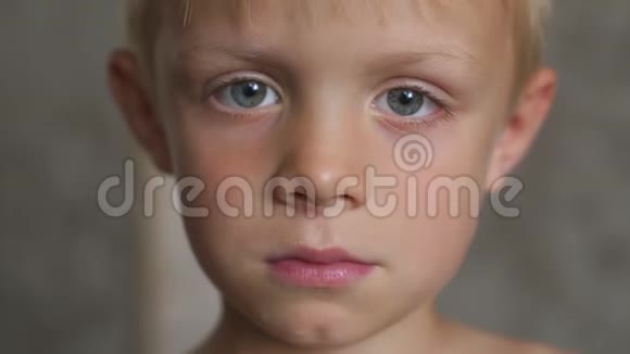 一个小男孩的特写脸鼻子被划伤了视频的预览图
