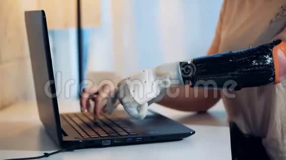 一位女士正在她的笔记本电脑上打字手里拿着健康的机器人手臂视频的预览图