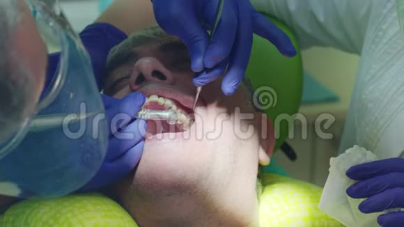 牙科诊所治疗牙痛关闭牙科医生钻病牙视频的预览图