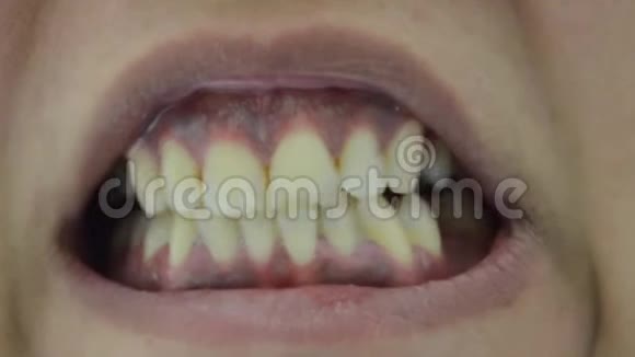露出丑陋的牙齿的人不刷牙视频的预览图
