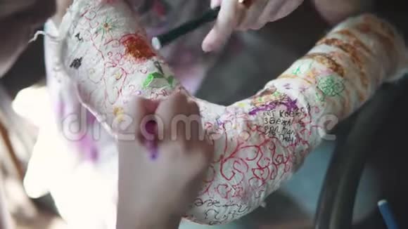 孩子们用绷带把一只涂满石膏的手臂画在一起姐姐鼓励和照顾生病的妹妹视频的预览图