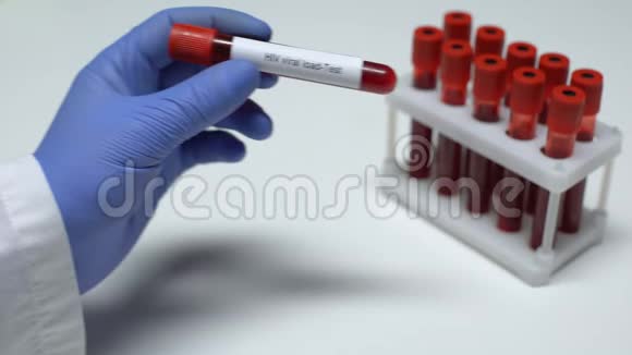 HIV病毒载量医生在试管中显示血样实验室研究健康检查视频的预览图