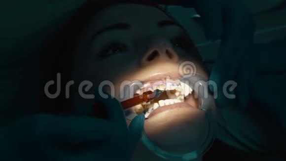 漂白凝胶在牙齿美白中的应用视频的预览图