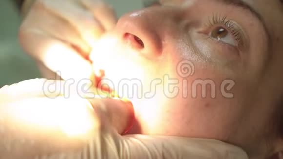 牙医使用牙科设备对病人牙齿进行工作视频的预览图