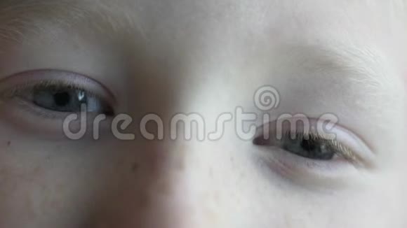宏观射击一个白化病金发男孩特写的眼睛视频的预览图