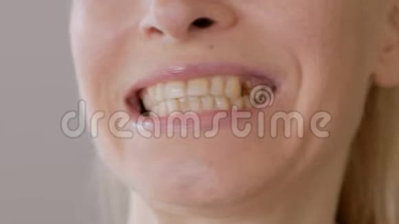 一位成年女性在检查她嘴里缺失的牙齿时的面部特写视频的预览图