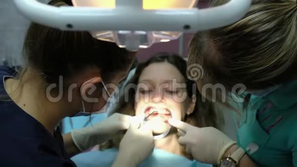 牙医和助手在安装支架系统特写之前从牙齿上清洗特殊凝胶访问视频的预览图