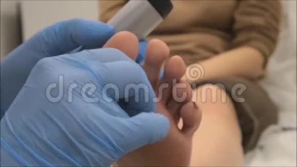 皮肤科医生用皮镜检查足底疣的病人视频的预览图