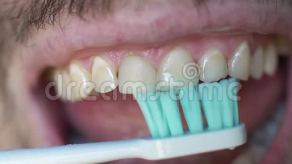 一群白人用电动牙刷刷牙人刷牙时张开嘴视频的预览图