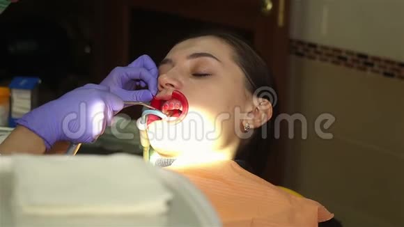 在牙科诊所有扩张器的年轻女子用水清洁牙齿现代牙科诊所视频的预览图