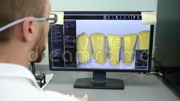 假牙数字建模实验室工作人员在计算机上开发颌骨模型视频的预览图