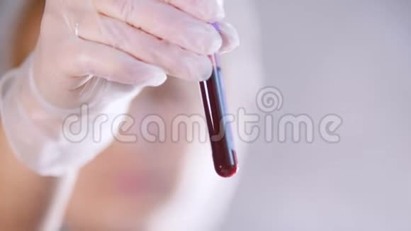 医疗诊所护士拿着装满血的试管关门视频的预览图