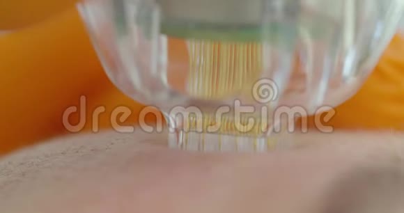 特写镜头微针射频提升程序硬件美容美容师进行面部复健手术视频的预览图