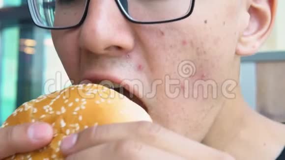 一个脸上长痘痘的年轻人吃汉堡包视频的预览图