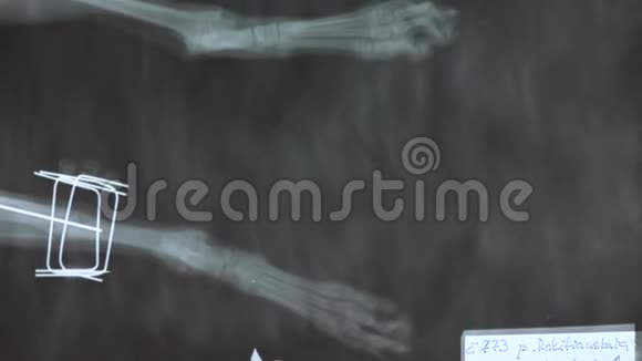 再基因的画面狗腿断了右腿兽医手术骨折视频的预览图