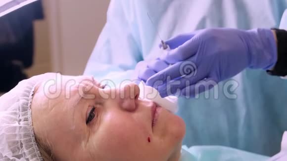 50岁的中年妇女在医生的脸上注射透明质酸视频的预览图