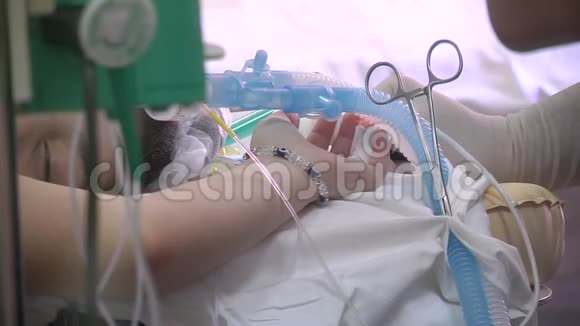麻醉下的病人在手术期间用面罩呼吸视频的预览图