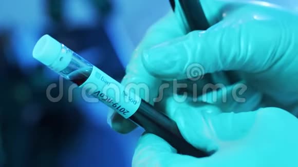 实验室试管中的血液和病毒诊所科学实验室的特写流行病保健疫苗视频的预览图