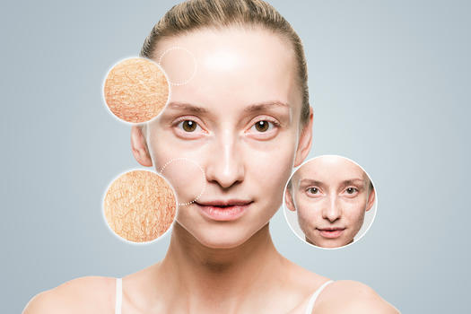 面部干燥皮肤改善图片素材免费下载