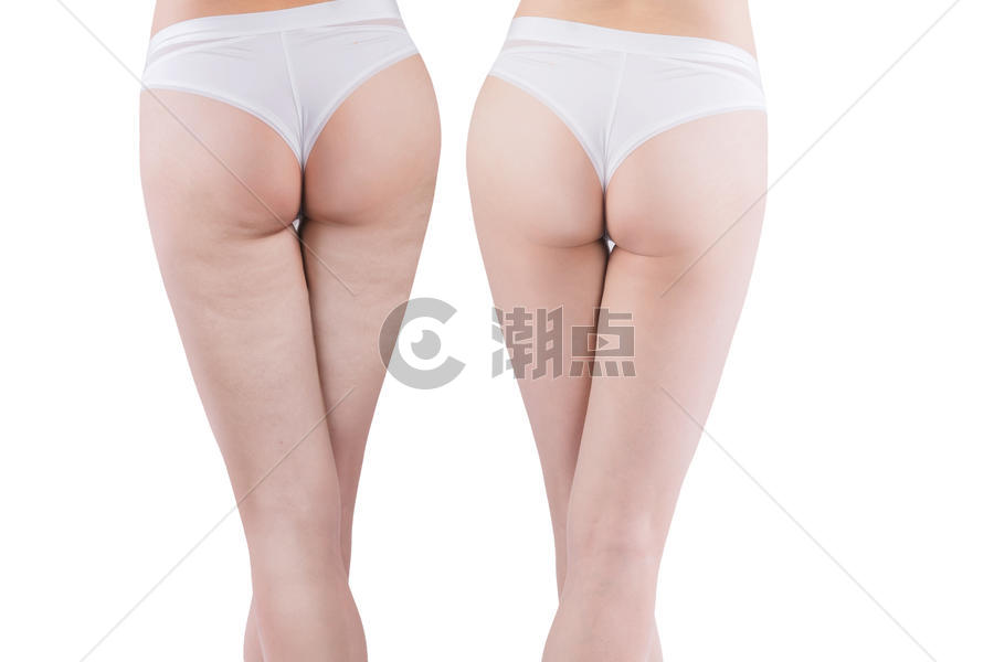 美女腿部美容对比图片素材免费下载