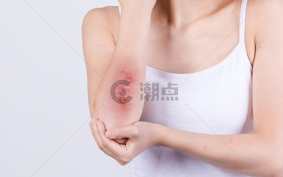 手肘疼痛的女人图片素材免费下载