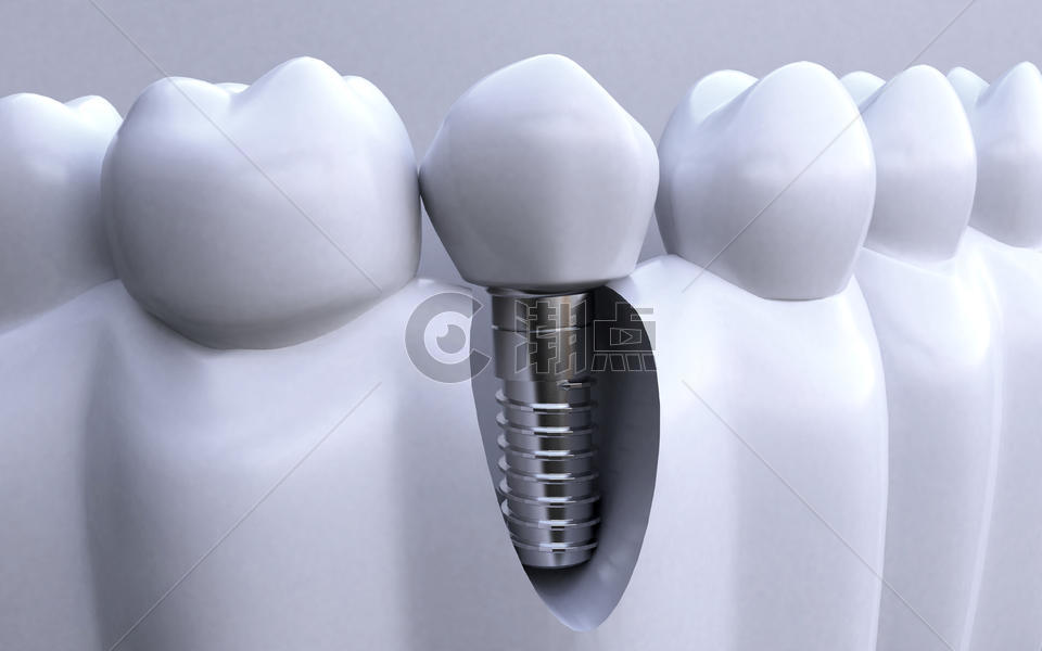 牙齿健康图片素材免费下载