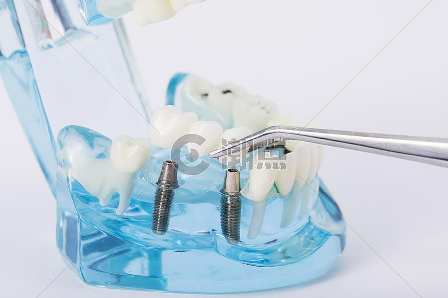牙齿模型图片素材免费下载