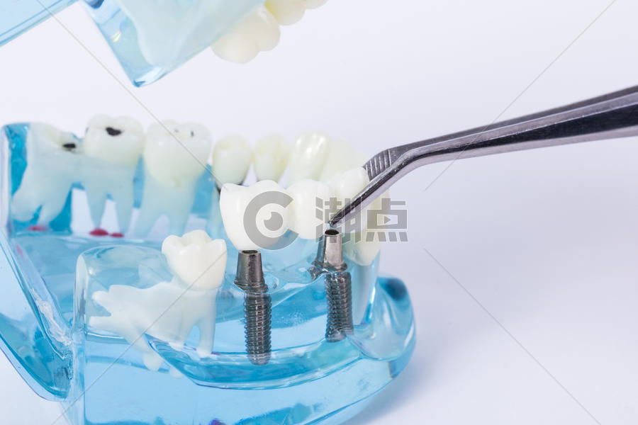 牙齿模型图片素材免费下载