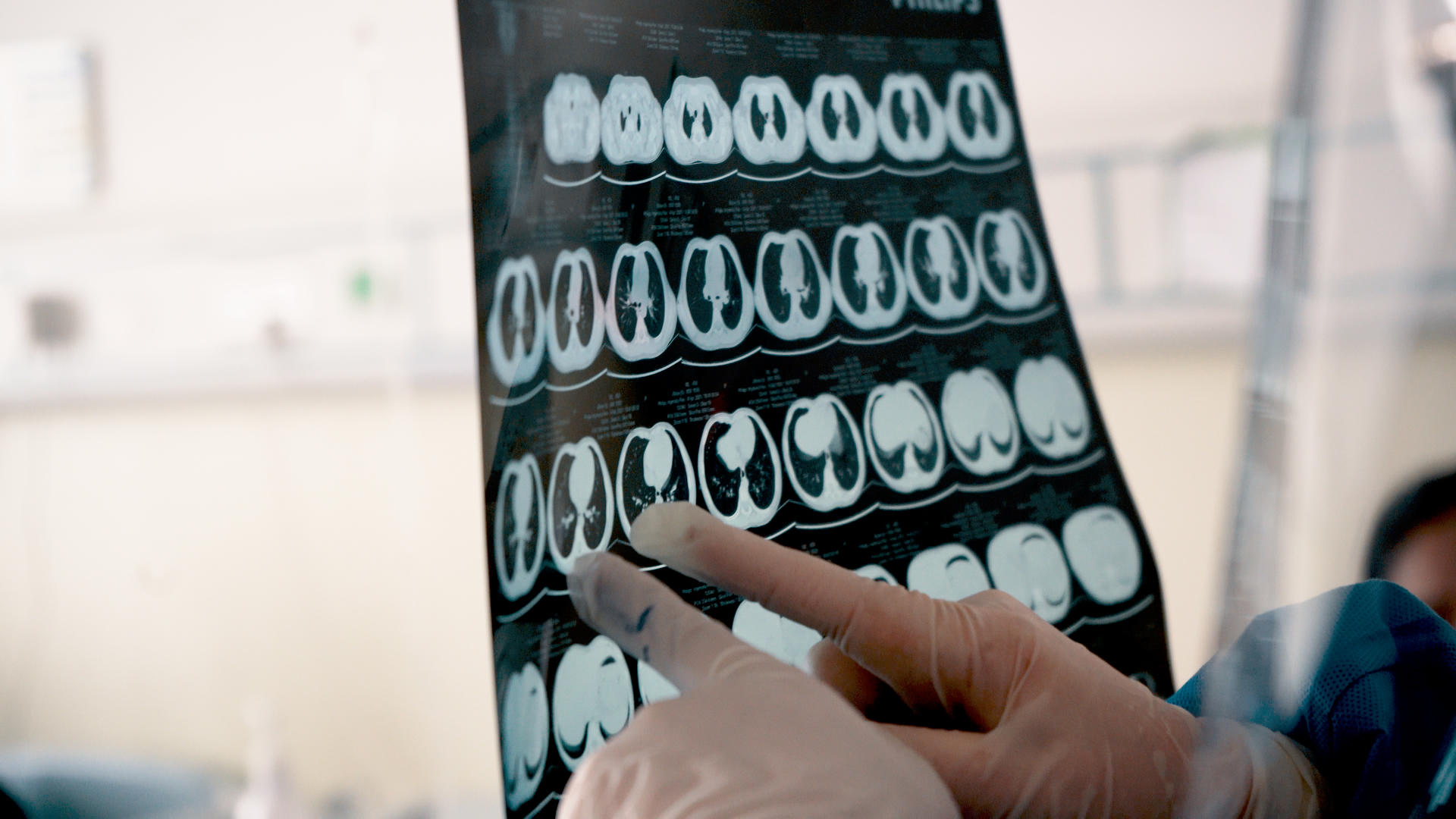 8k医生在病房里查看患者肺部x光片视频的预览图