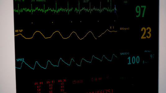 8k实拍医院病房监护仪视频的预览图
