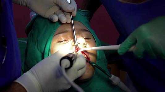 口腔外科手术牙齿胶切除视频的预览图