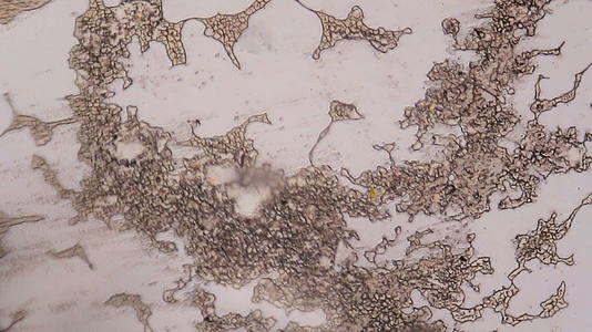 在显微镜下凝结血细胞视频的预览图