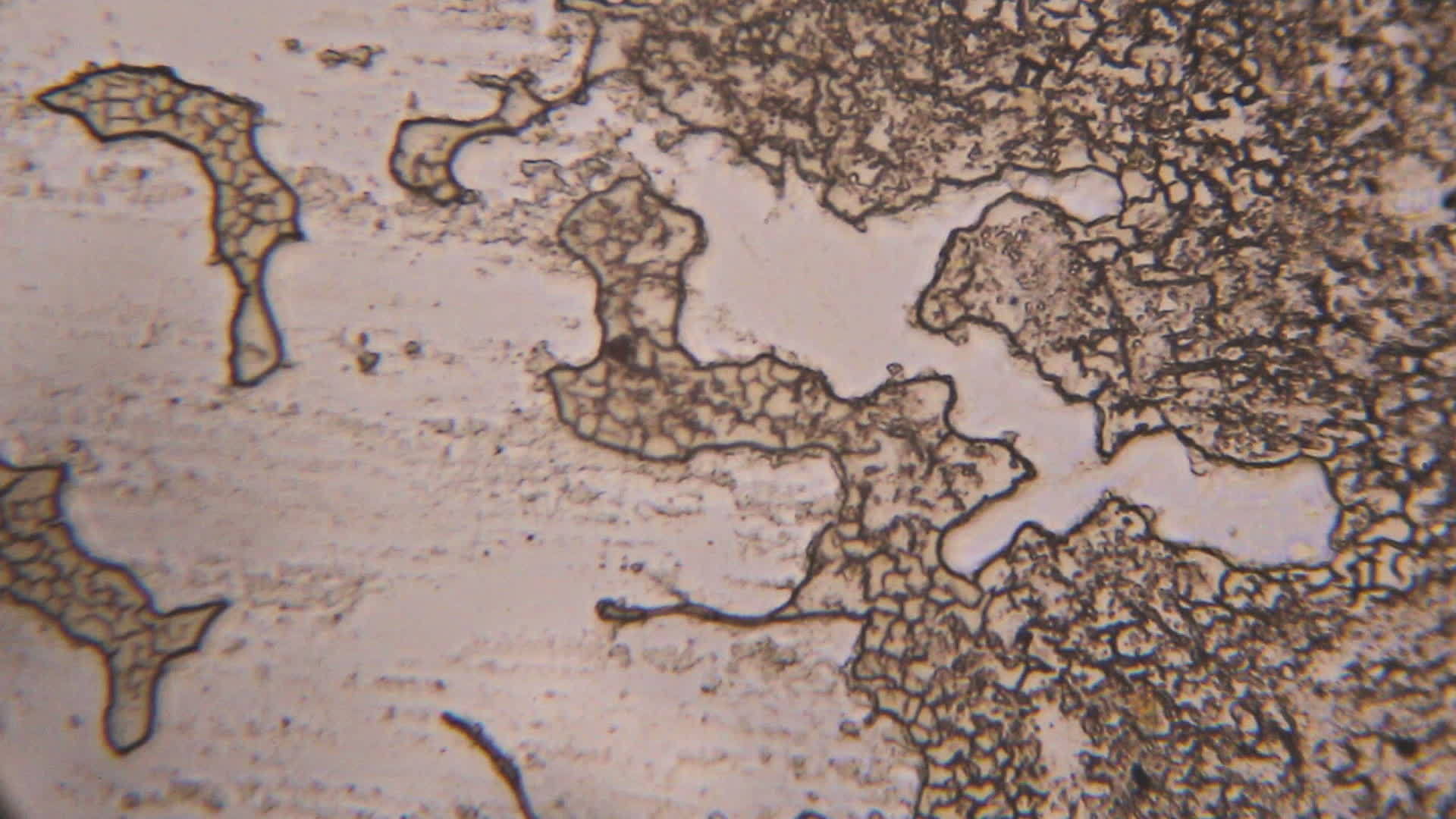 在显微镜下凝结血细胞视频的预览图